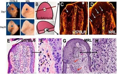 Epithelial–mesenchymal transition: an organizing principle of mammalian regeneration